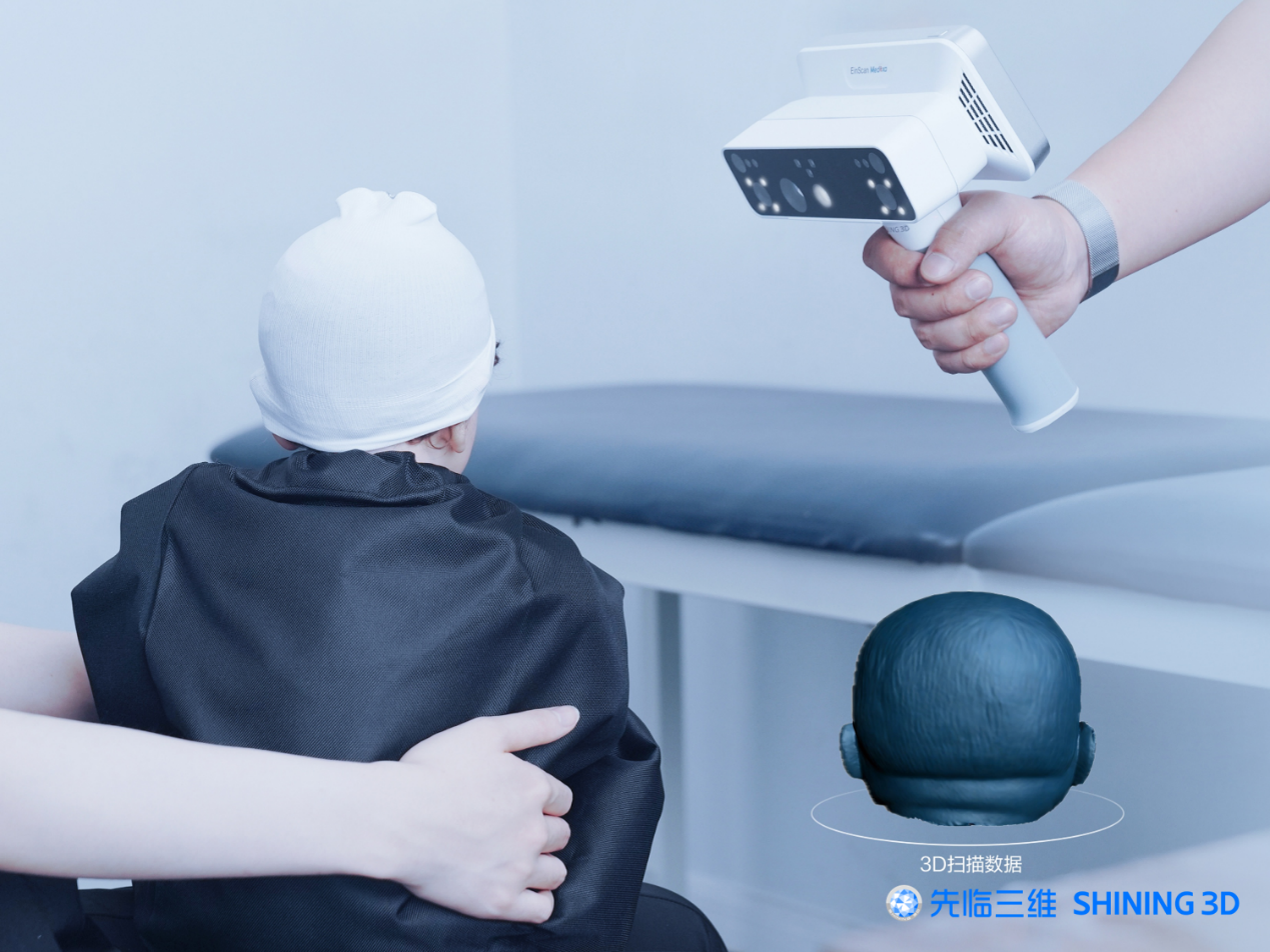 人体测量新方案先临三维新品EinScanMedixa双光源无线D扫描仪重磅来袭！(图3)